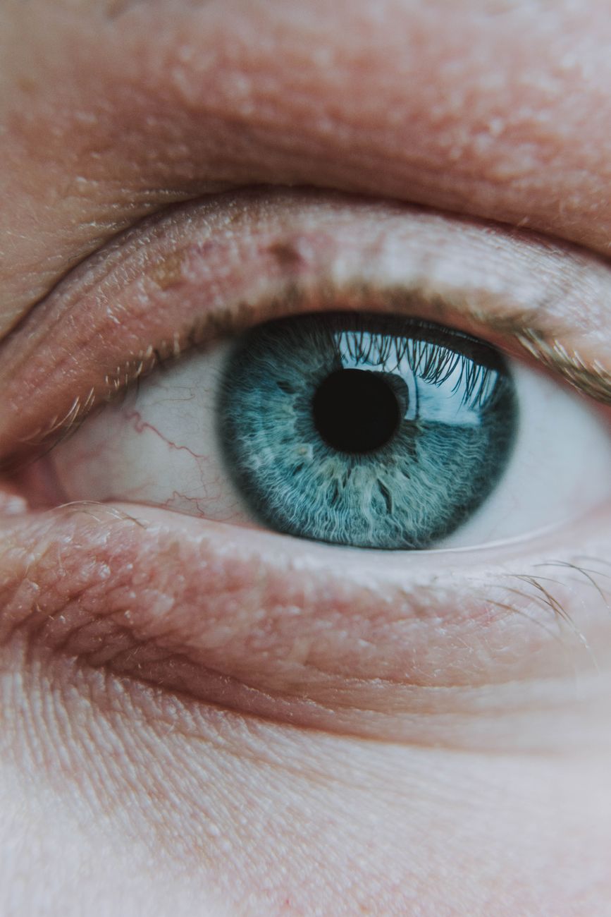 Eye drops